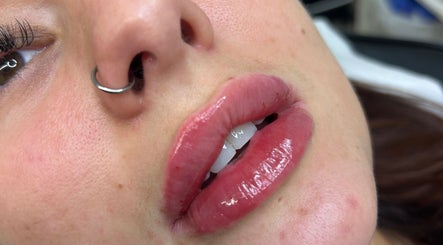 Close-up of glossy lips treatment at Gabrielle Aesthetics, Lichfield, England, GB.