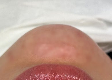 Close-up of glossy lips at Gabrielle Aesthetics, Lichfield, England, GB showcasing beauty treatment results.