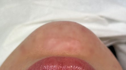 Close-up of glossy lips at Gabrielle Aesthetics, Lichfield, England, GB showcasing beauty treatment results.