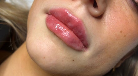 Close-up of glossy lips at Gabrielle Aesthetics in Lichfield, England, GB. Highlighting expert lip care.