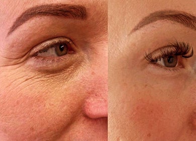 Before and after eyelash treatment at Lowes Lashes Aesthetics Sunbed, Faversham, England, GB.