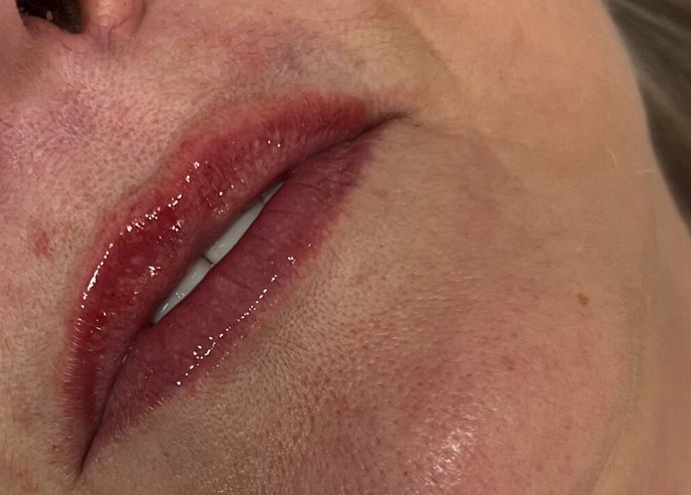 Close-up of glossy lips after treatment at Lowes Lashes Aesthetics Sunbed in Faversham, England, GB.