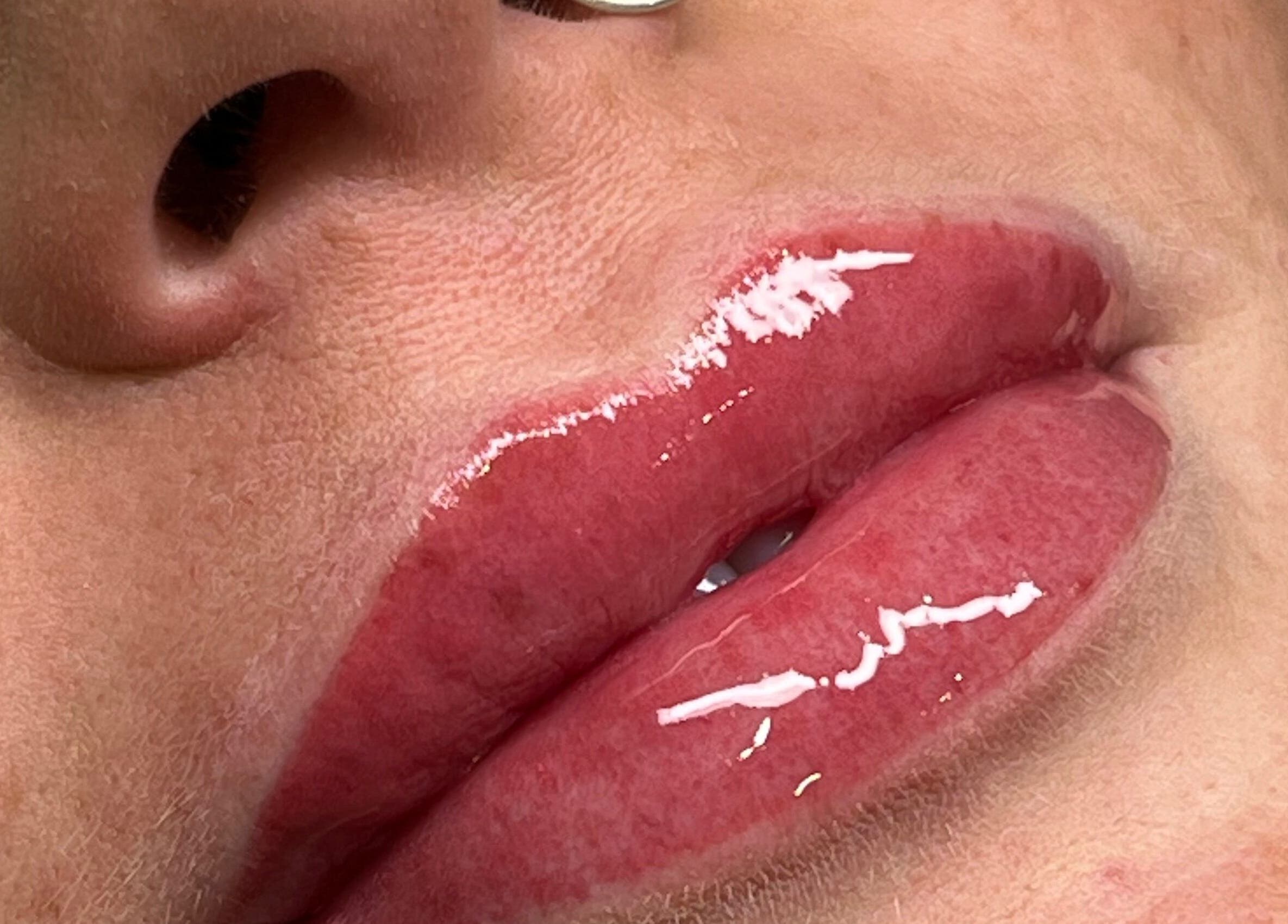 Glossy lip treatment at Inkd Aesthetics, Surfers Paradise, Queensland, AU for perfect beauty enhancement.