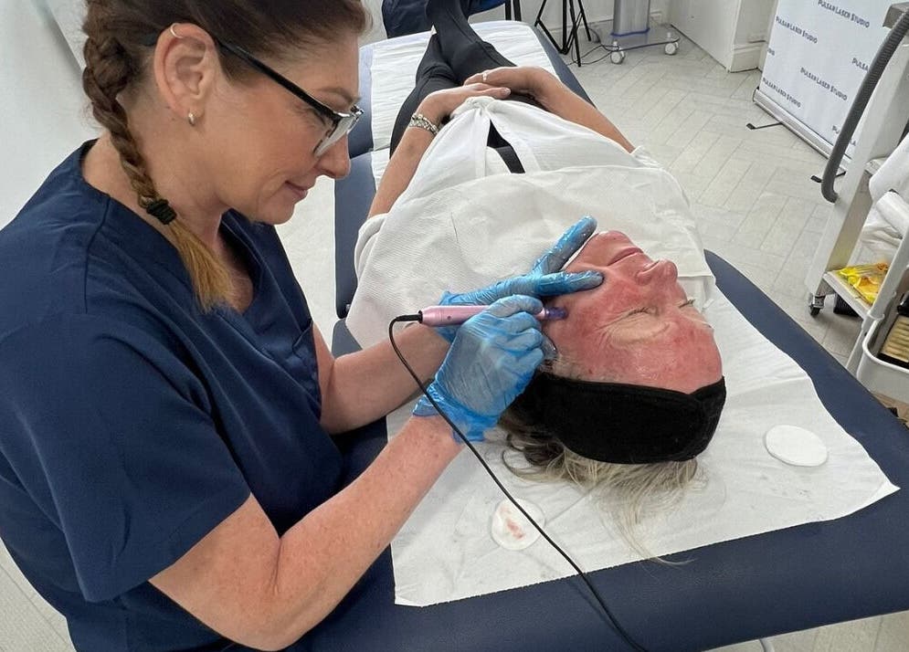 Aesthetician performing laser skin treatment at Pulsar Laser Studio, Bolton, England, GB.