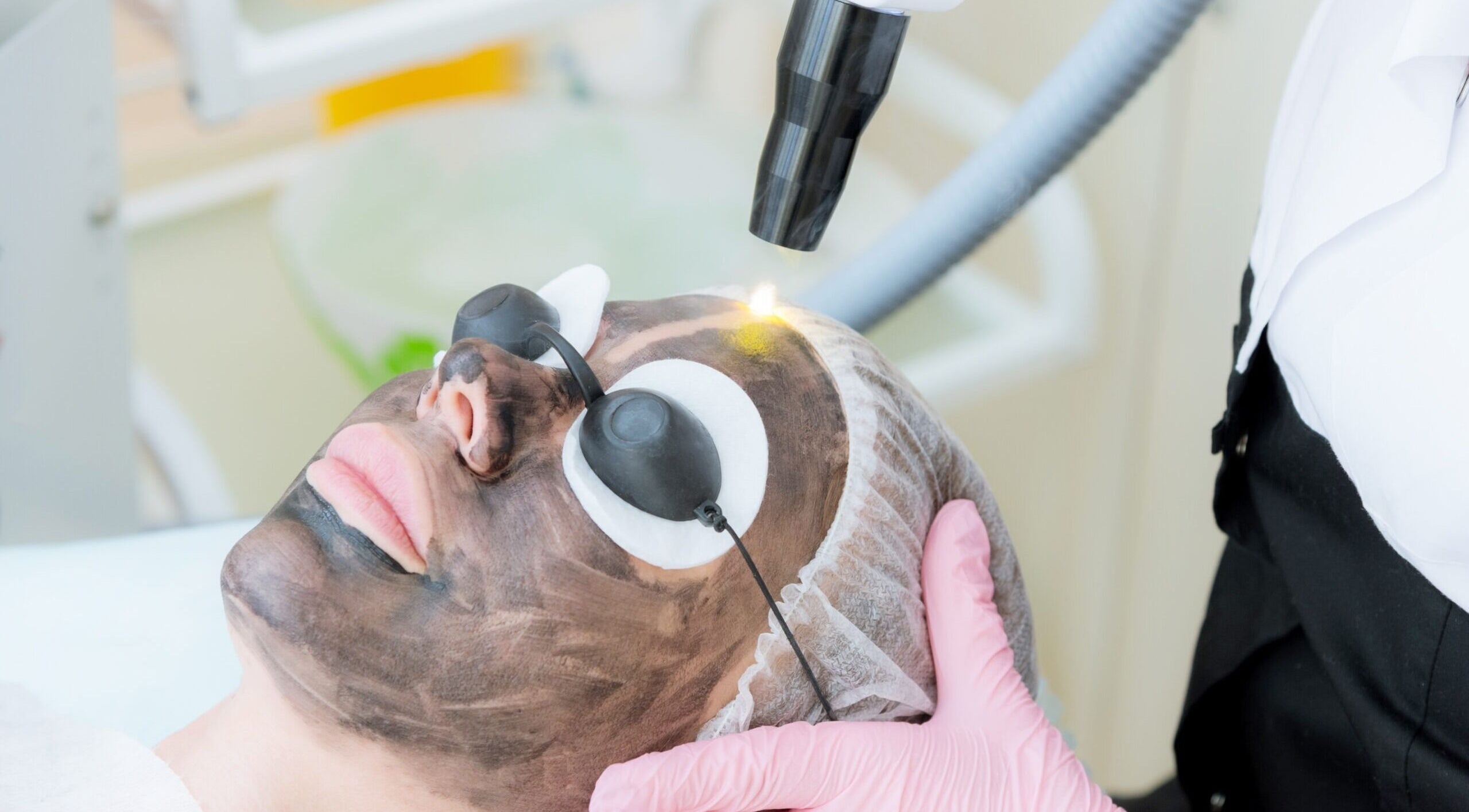 Carbon laser facial at Pulsar Laser Chorley in Chorley, England, GB showcasing rejuvenating skincare treatment.