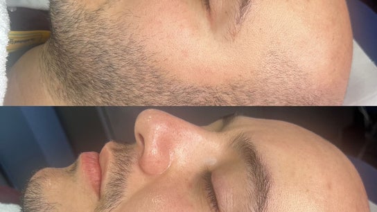 Pulsar Laser Chorley 3