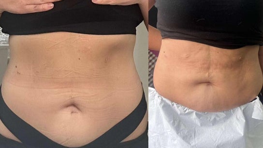 Pulsar Laser Chorley 5