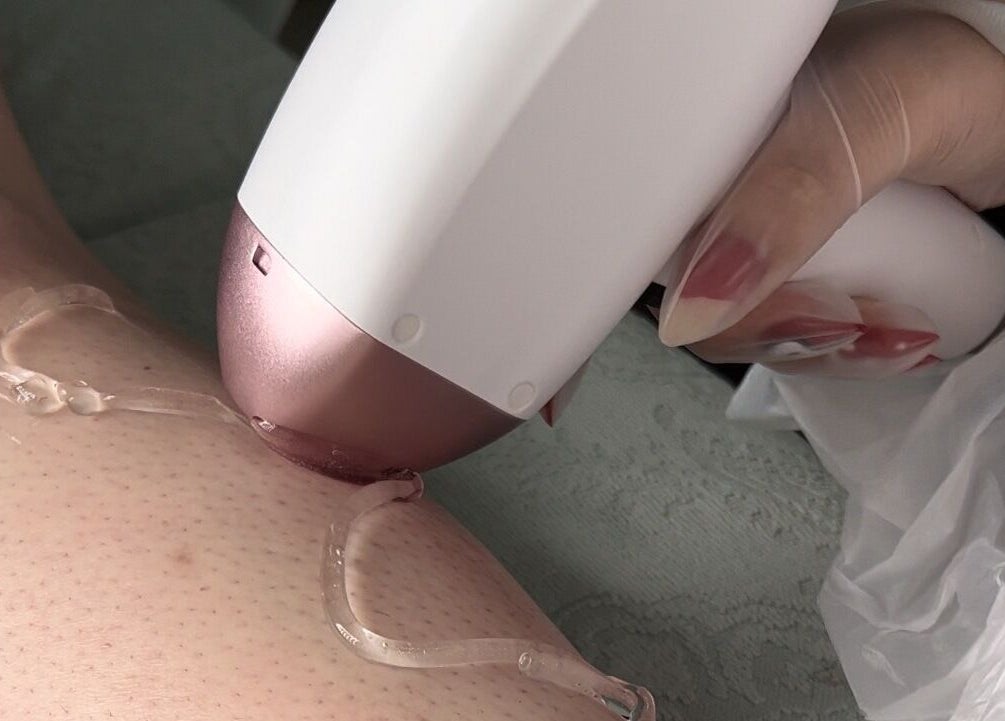 Laser hair removal at Nail Salon Qualitatif in Port Elizabeth, Eastern Cape, ZA.