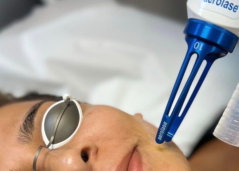 Laser facial treatment at The O Spot Skin Care Clinic, Ajax, Ontario, CA, enhancing skin vitality.