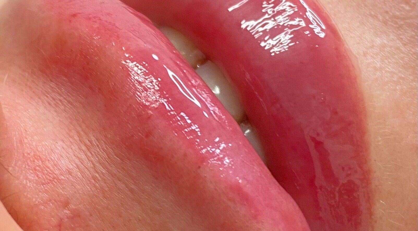 Close-up of glossy lips treated at JCandy Beauty Services, rebranding to Nadra Beauty soon, in Birmingham, England, GB.