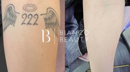 Bianco Beauty Birmingham image 3