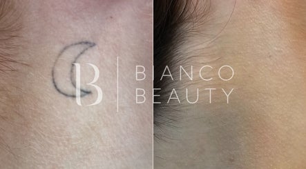 Bianco Beauty Birmingham kép 3