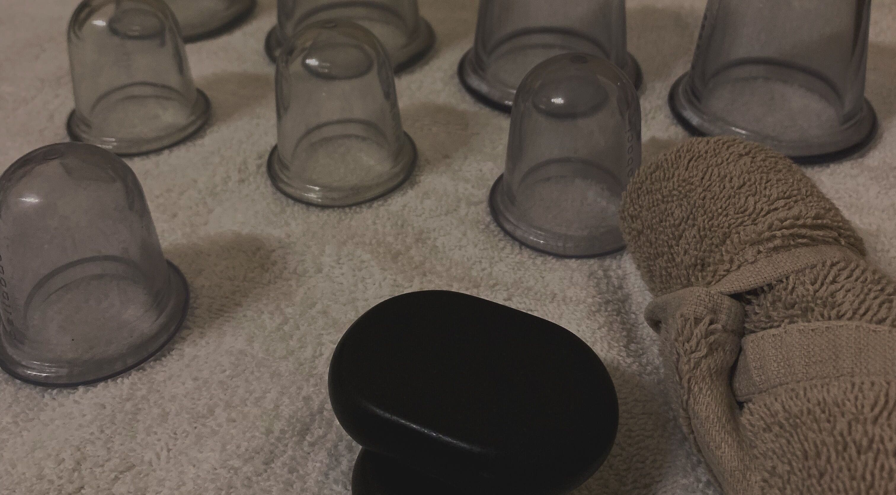 Cupping therapy tools at Walvis Bay Branch, Walvis Bay, Erongo Region, NA, highlighting wellness services.