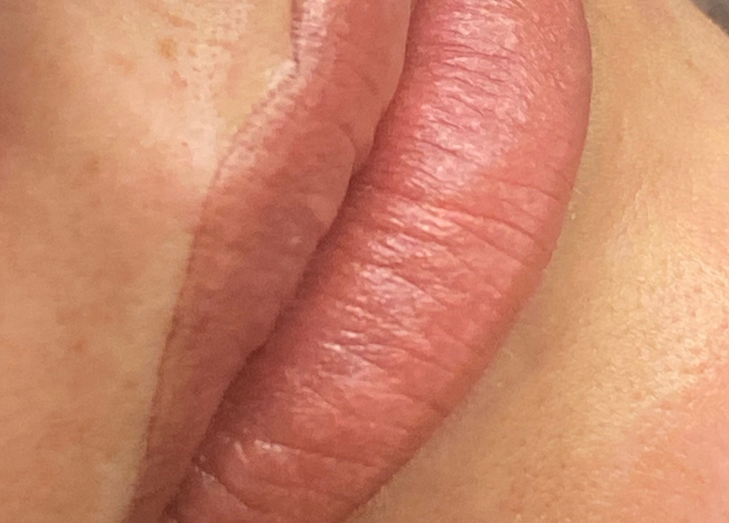 Popolna transformacija ustnic v Beauty Pro Lab, Bratislavský kraj, SK.