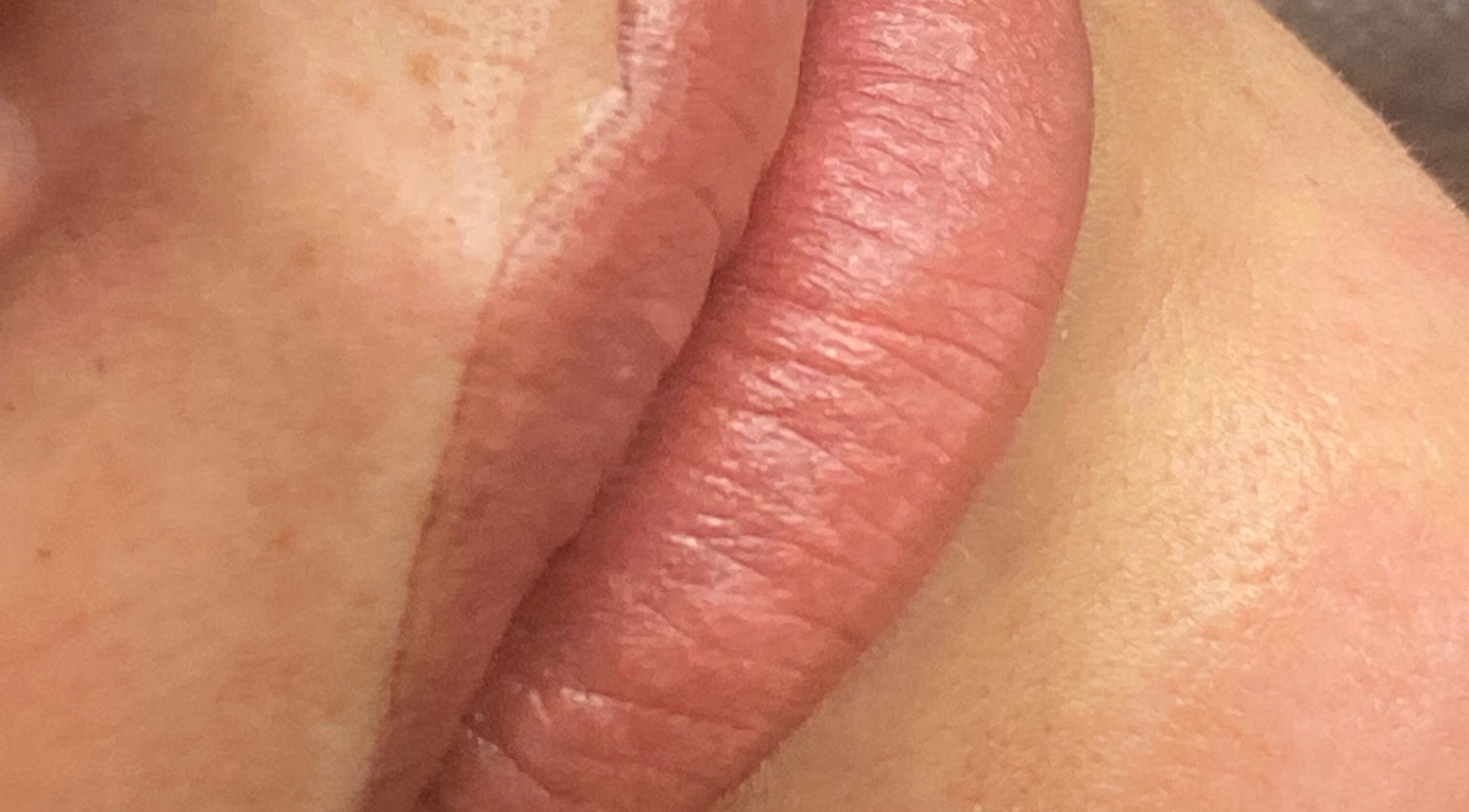 Popolna transformacija ustnic v Beauty Pro Lab, Bratislavský kraj, SK.