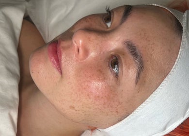 Relaxed woman at That Glow spa, Melbourne, Victoria, AU experiencing a rejuvenating facial treatment.