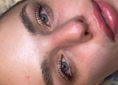 Close-up of a face with flawless skin at That Glow, Melbourne, Victoria, AU.