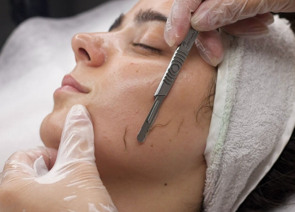 Dermaplaning treatment at Sattva Aesthetics, Caringbah, New South Wales, AU. Smooth skin for radiant glow.