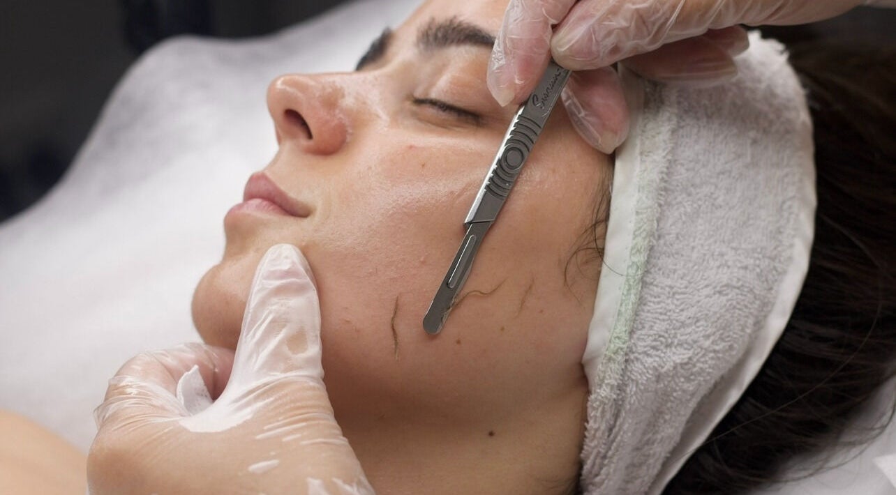 Dermaplaning treatment at Sattva Aesthetics, Caringbah, New South Wales, AU. Smooth skin for radiant glow.