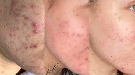 Ph Skincare  kép 2