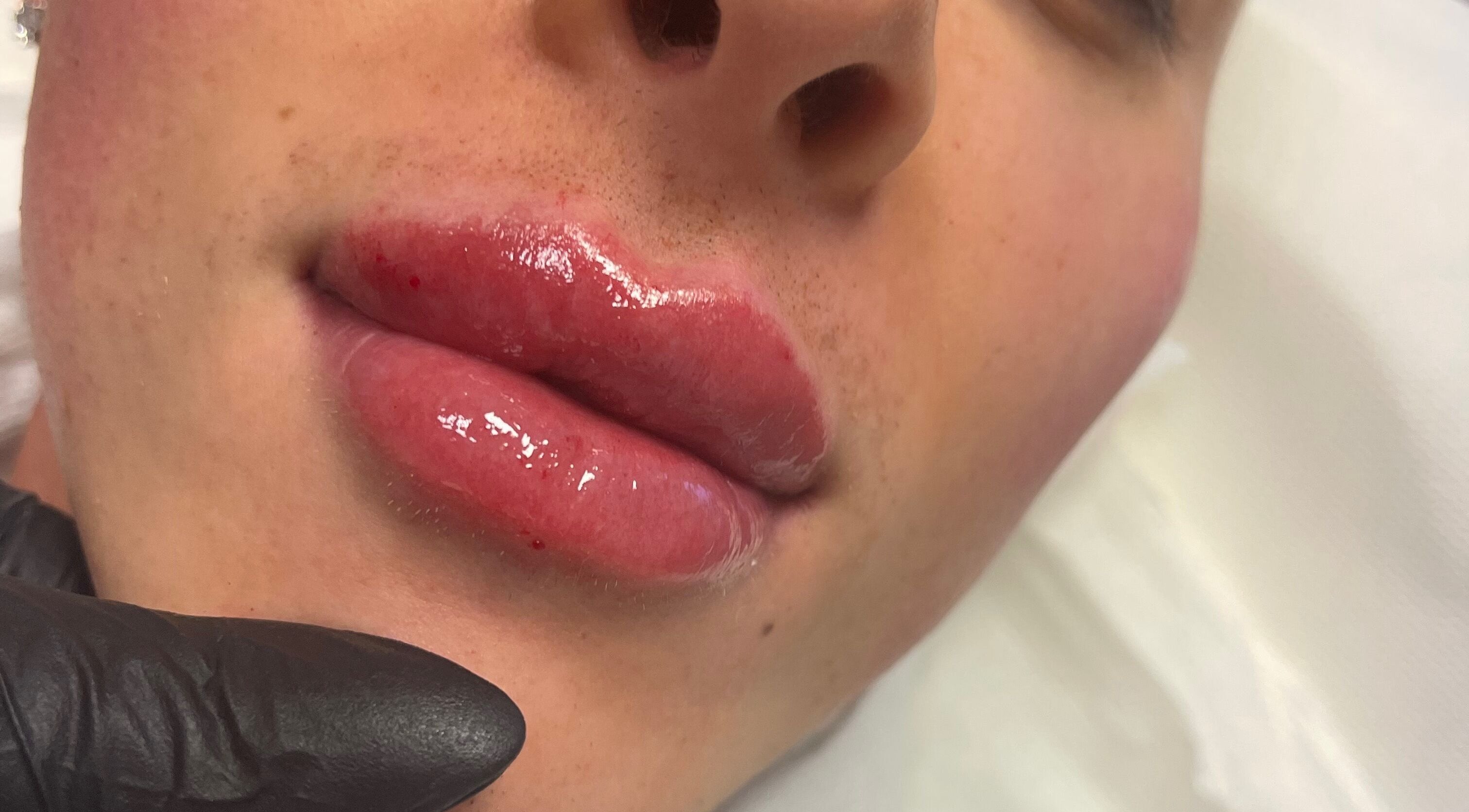 Close-up of glossy lips treatment at M D Aesthetics in Morpeth, England, GB. Enhancing beauty and confidence.