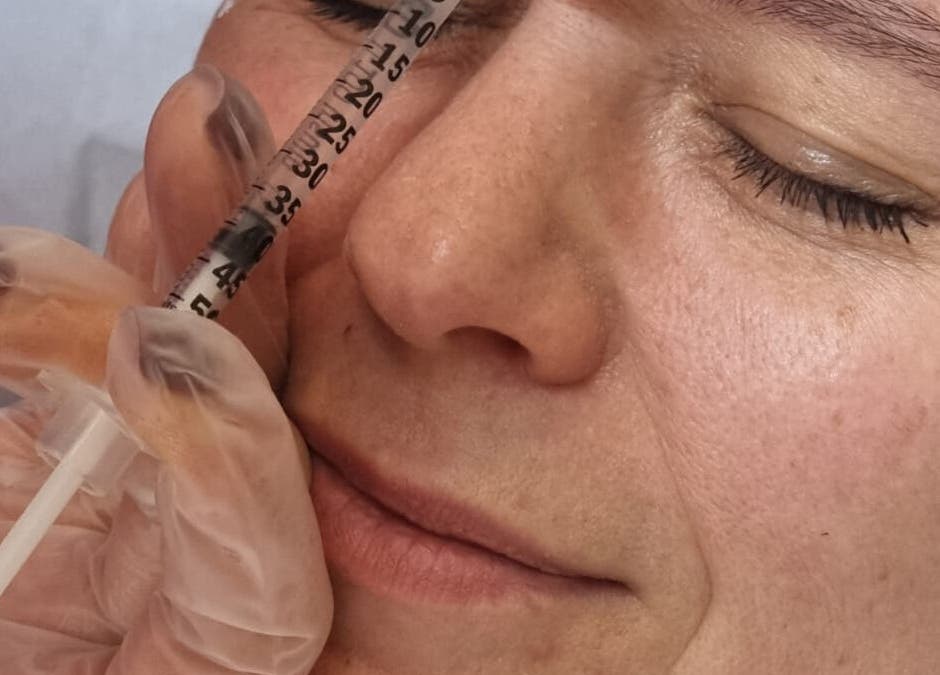 Close-up of a cosmetic procedure at Skin Aesthetic in Trowbridge, England, GB, highlighting facial care.