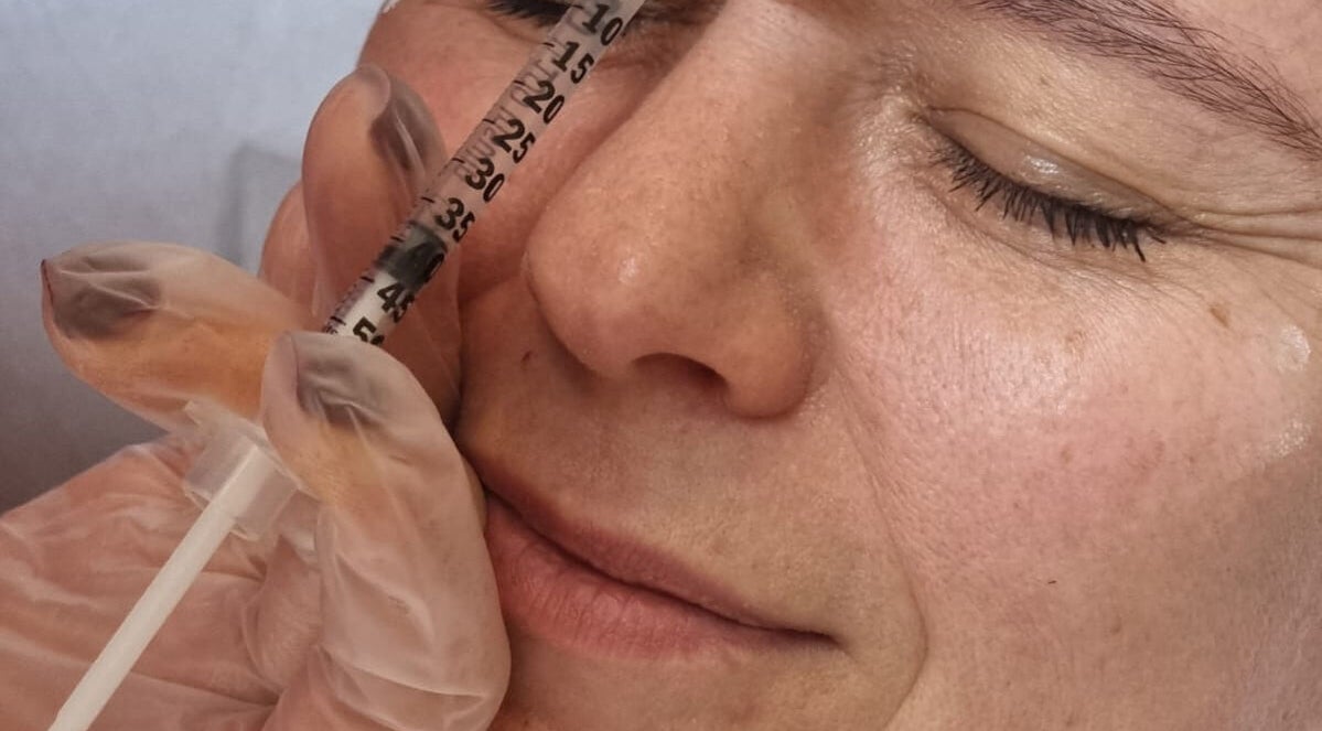Close-up of a cosmetic procedure at Skin Aesthetic in Trowbridge, England, GB, highlighting facial care.