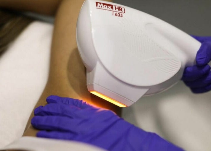Laser hair removal at Adore Medispa, Cancún, Quintana Roo, MX. Precision and care in a serene setting.