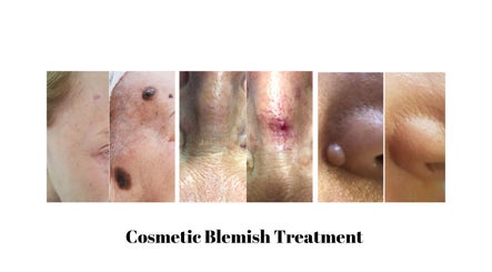 ZAP Skin, Laser and Beauty