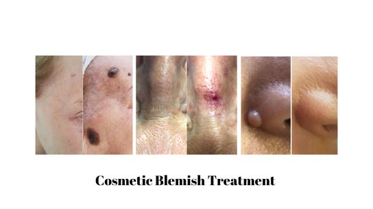 ZAP Skin, Laser and Beauty