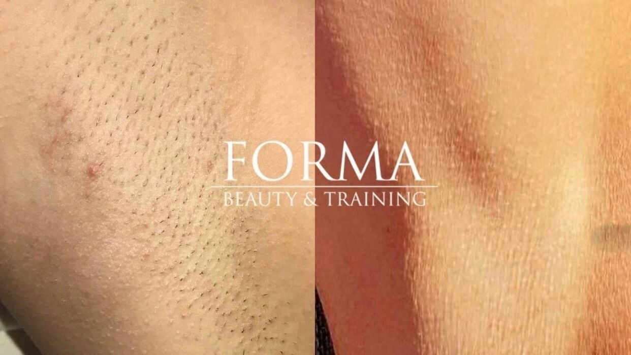 Formabeauty - 1