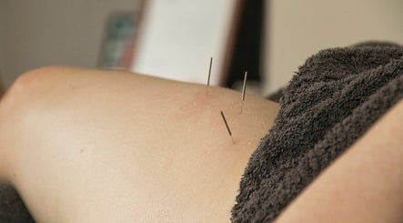 In-Person Clinical Myotherapy | Fallaw Myotherapy & Fitness, bilde 3