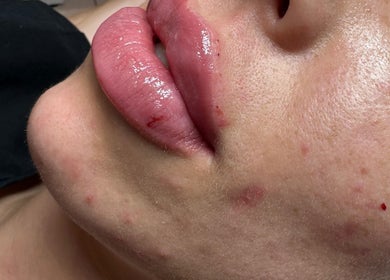 Close-up of smooth, treated lips at Dolly Rocks Beauty, Aesthetics & Laser in Gorseinon, Wales, GB.