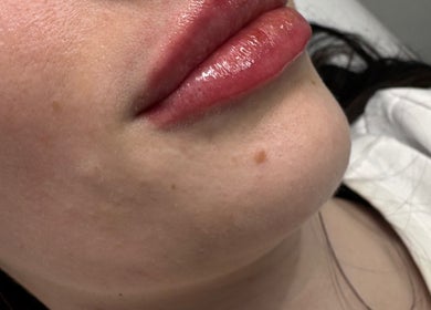 Close-up of enhanced lips at Dolly Rocks Beauty, Aesthetics & Laser, Gorseinon, Wales, GB.