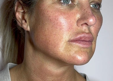 Close-up of radiant skin after treatment at Dolly Rocks Beauty, Aesthetics & Laser, Gorseinon, Wales, GB.