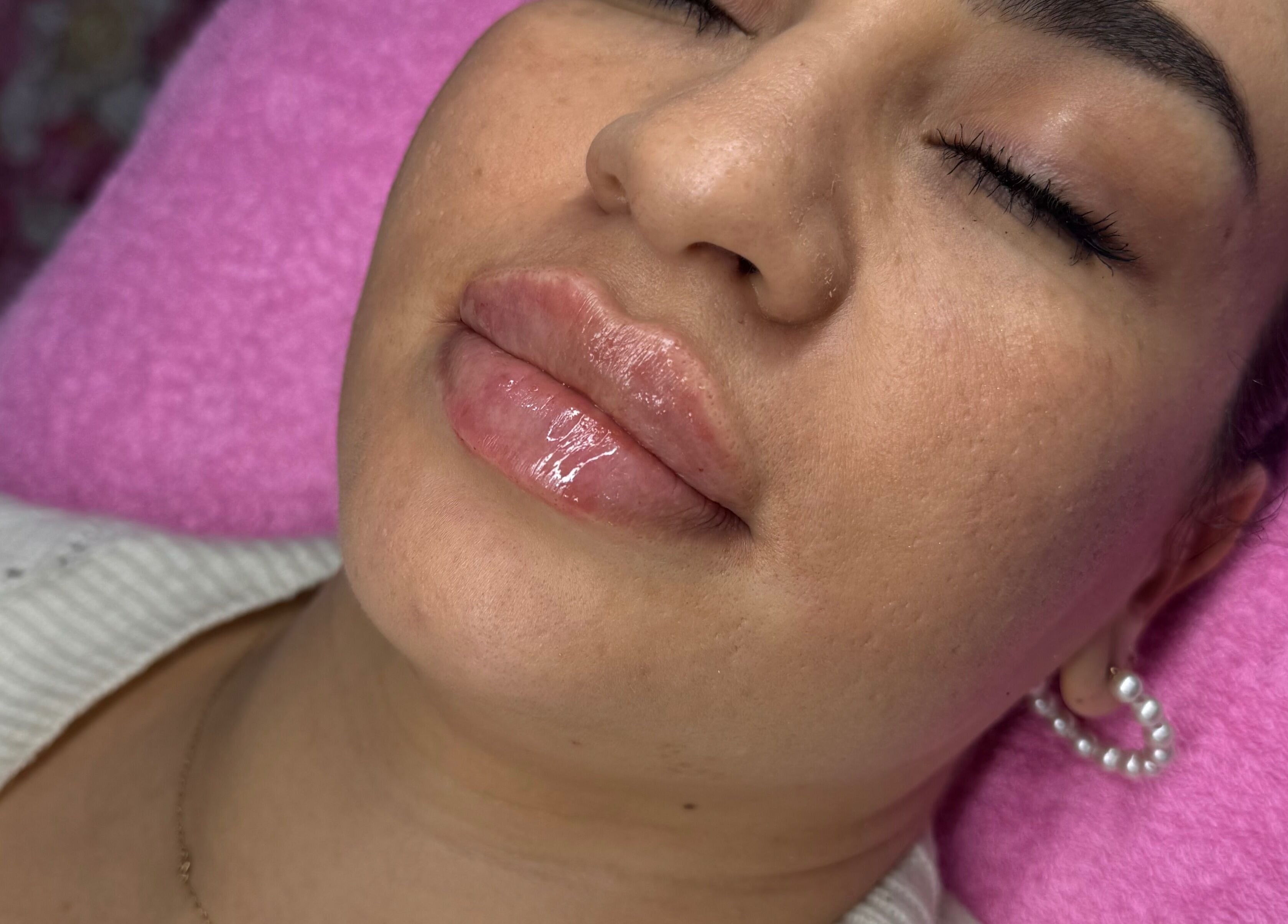 Relaxed client with glossy lips at Elladoons Aesthetics in Smallford, England, GB.