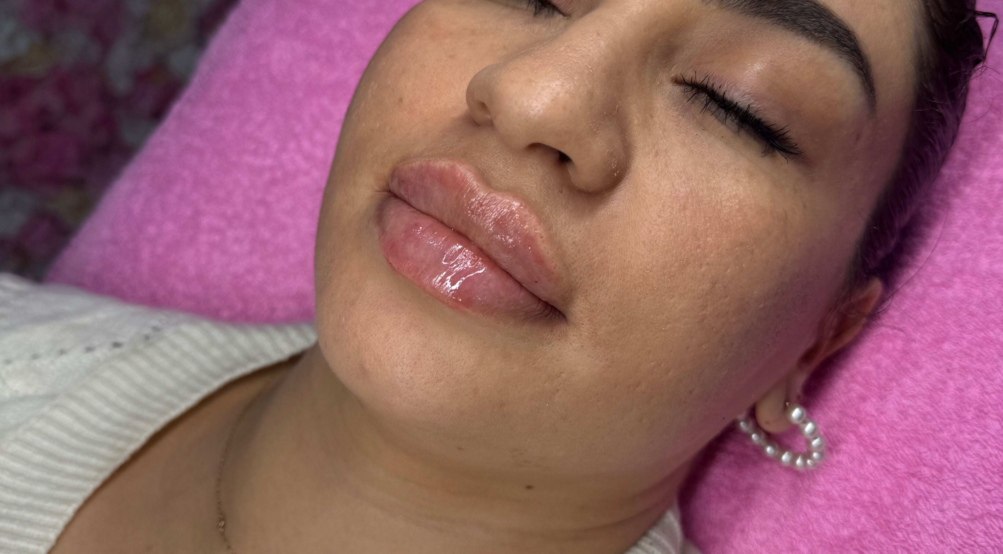 Relaxed client with glossy lips at Elladoons Aesthetics in Smallford, England, GB.