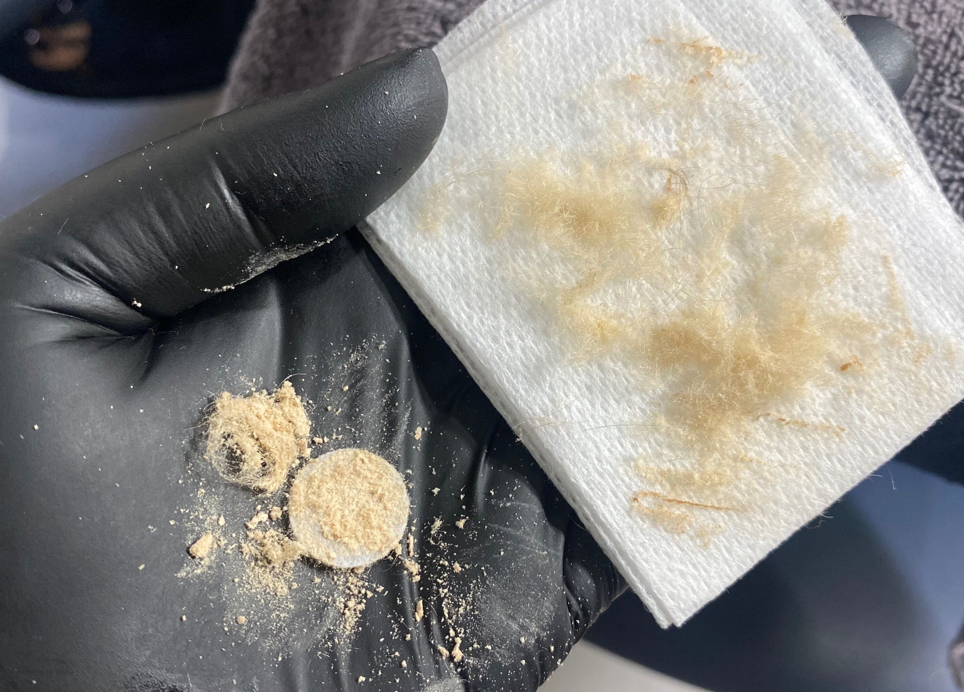 Close-up of exfoliated skin debris at Frankly Beautiful, Emu Heights, New South Wales, AU, showcasing skincare results.