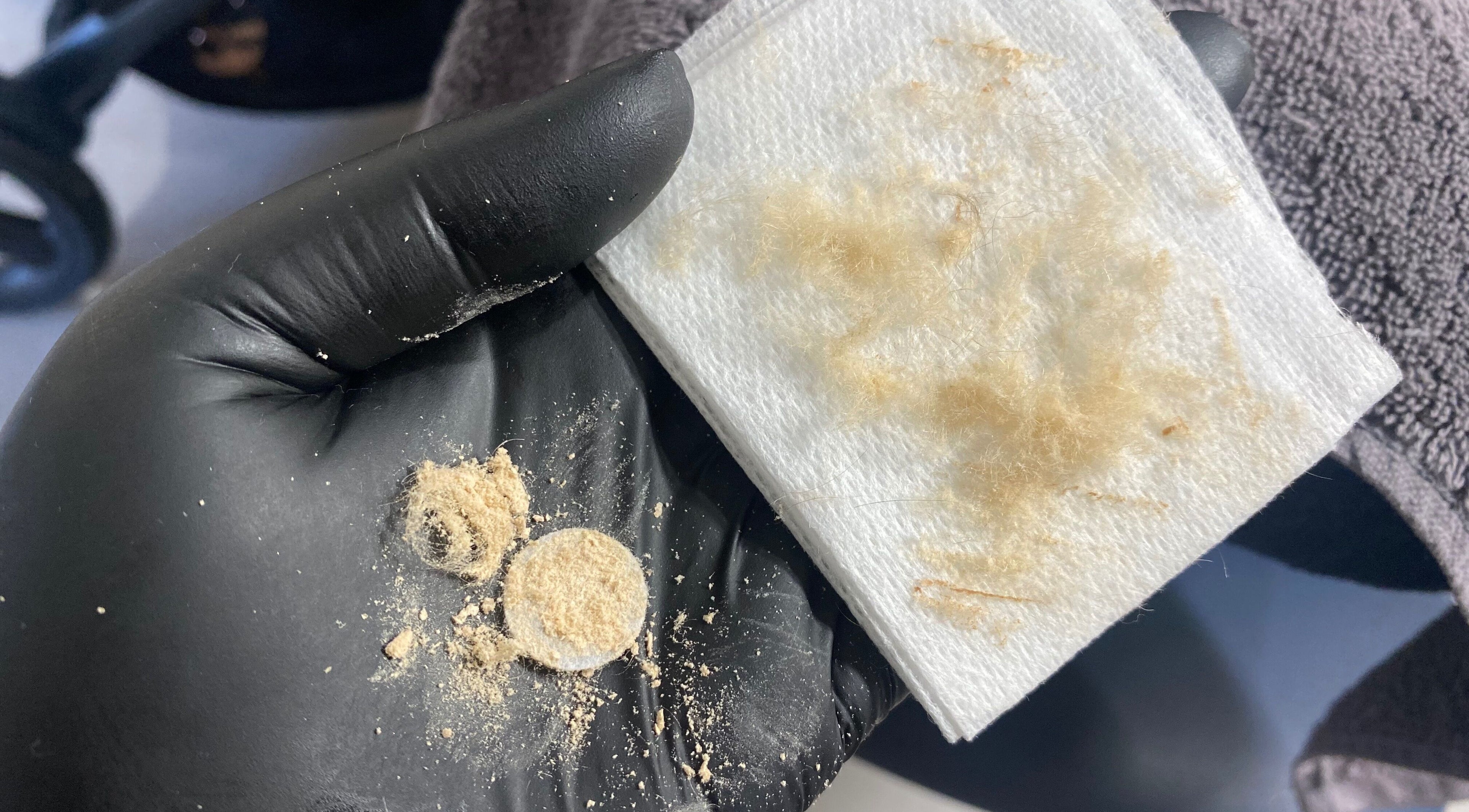 Close-up of exfoliated skin debris at Frankly Beautiful, Emu Heights, New South Wales, AU, showcasing skincare results.