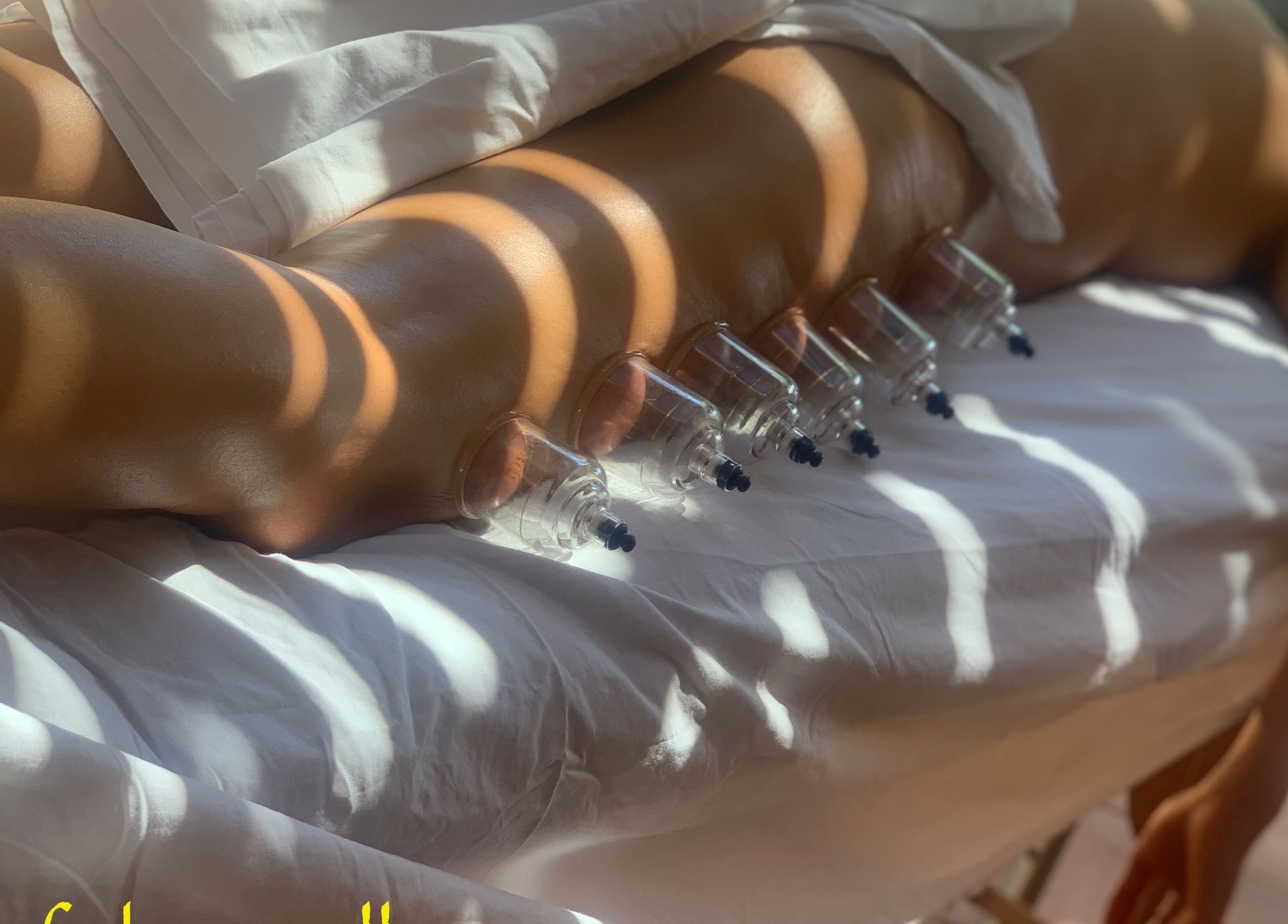 Cupping therapy at Fokas Wellness Athens, relaxing ambience in Athens, GR offering holistic wellness.