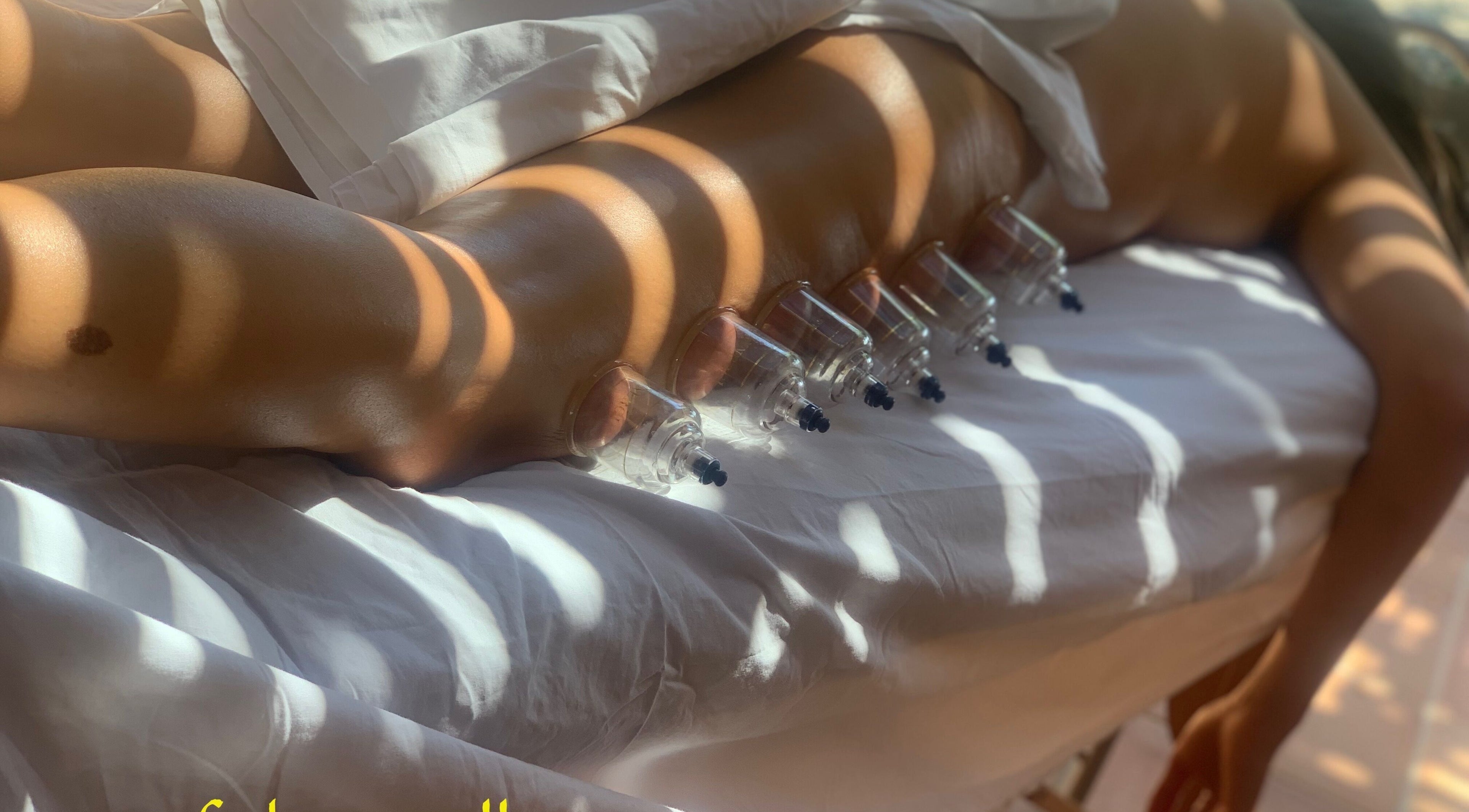 Cupping therapy at Fokas Wellness Athens, relaxing ambience in Athens, GR offering holistic wellness.