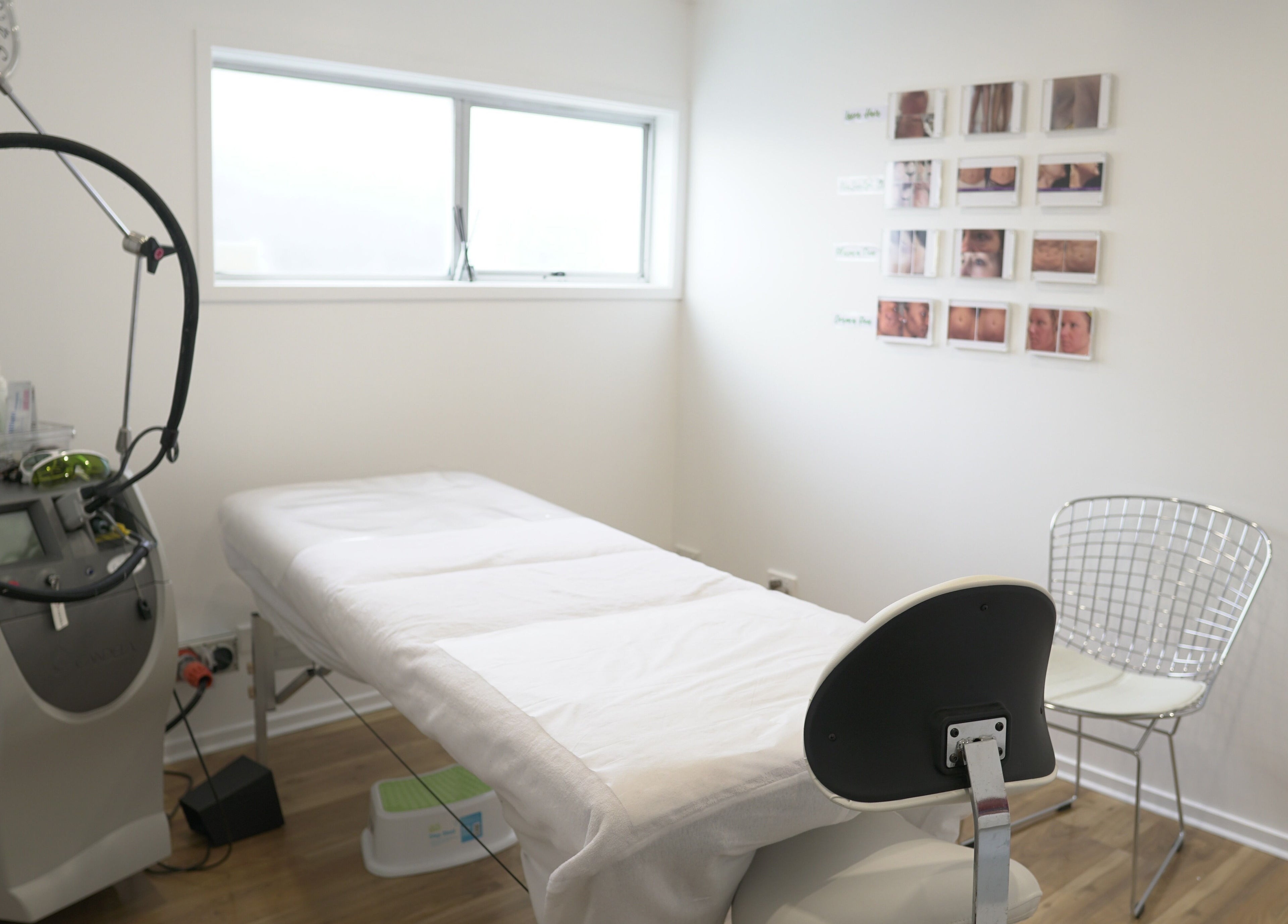Calm and modern treatment room at Beautilase, Auckland, Auckland, NZ, featuring a treatment bed and equipment.