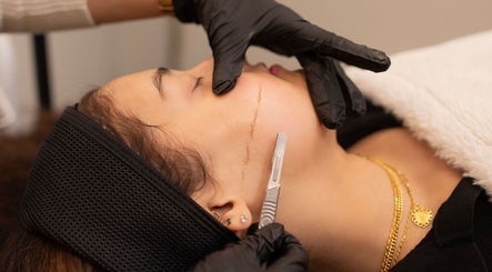 Dermaplaning at The Vancouver Aesthetician - Lower Lonsdale, North Vancouver, British Columbia, CA.