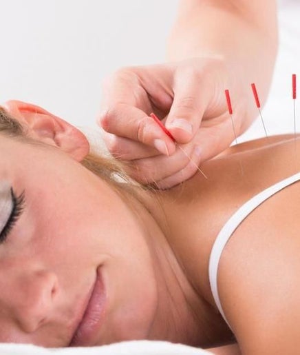 Maggie Shao Acupuncture image 2