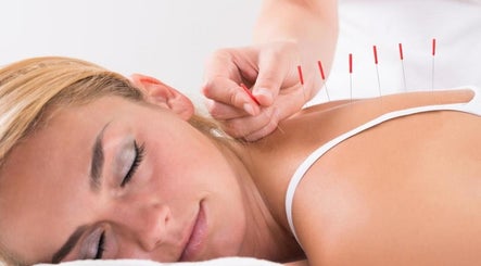 Maggie Shao Acupuncture
