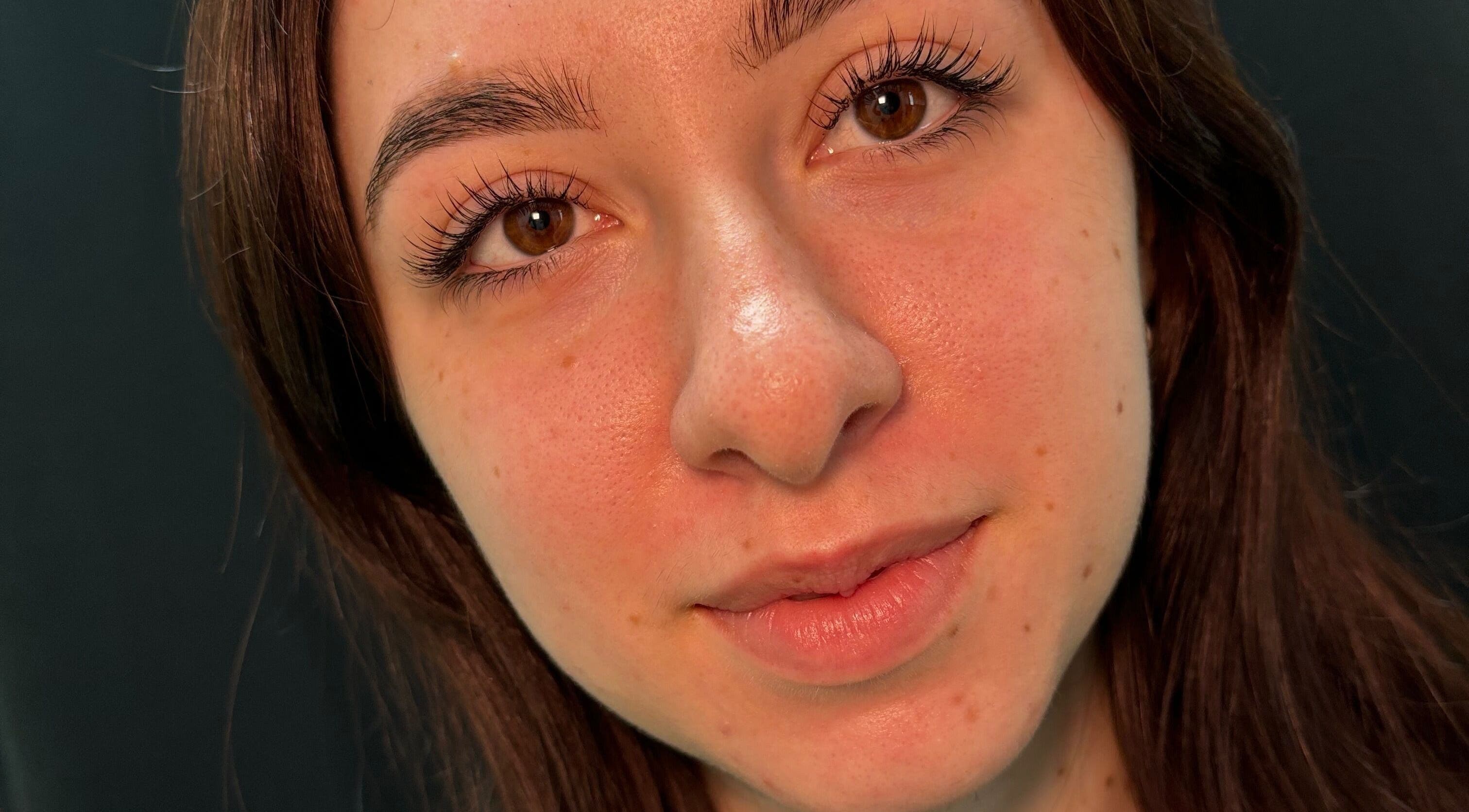 Close-up of radiant skin after treatment at Aesthetician Mariana, New Westminster, British Columbia, CA.