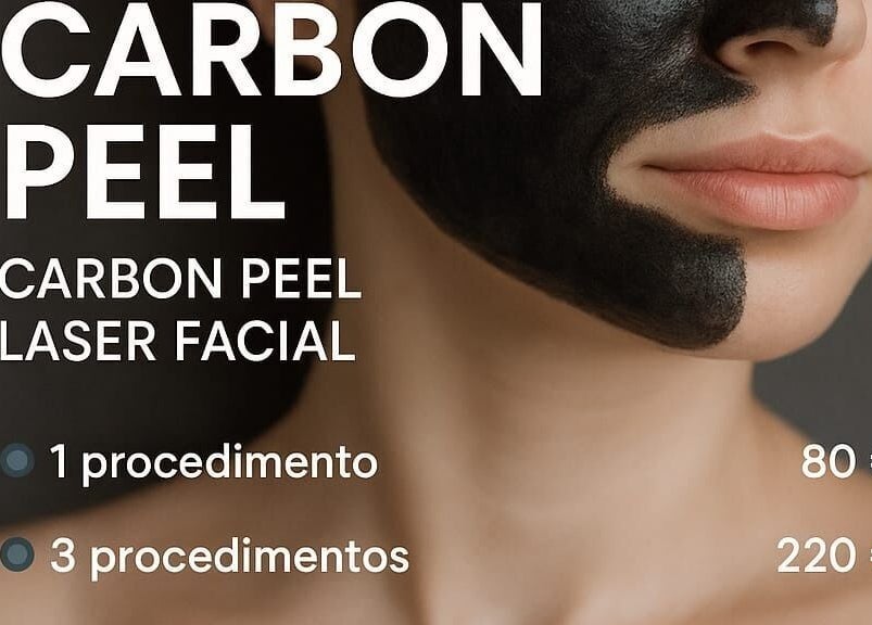 Процедура углеродного пилинга на лице в Effect Studio, Фару, Фару, ПТ.