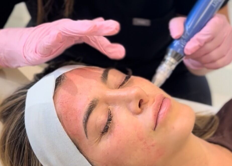 Facial treatment at Ethereal Aesthetics, London, England, GB for rejuvenated skin glow.