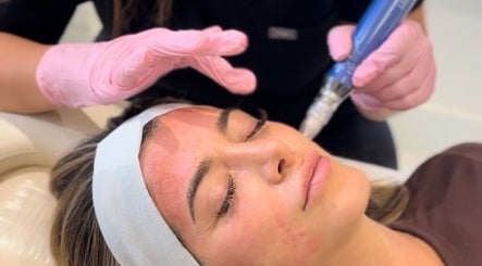 Facial treatment at Ethereal Aesthetics, London, England, GB for rejuvenated skin glow.