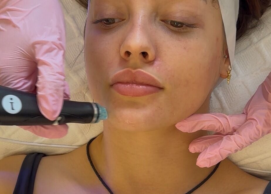 Hydrafacial treatment at Ethereal Aesthetics, London, England, GB, for rejuvenated skin.